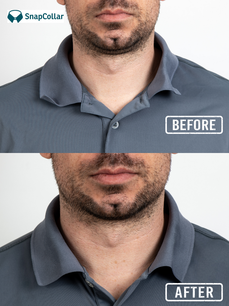 Graphic of before and after photos after SnapCollar was applied to a shirt with the before photo with curling corners and wrinkles and the after photo with a perfectly pressed collar